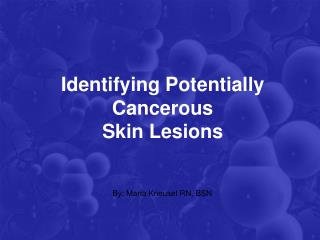Identifying Potentially Cancerous Skin Lesions