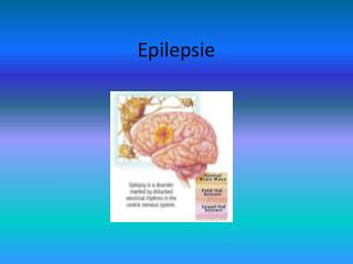 Epilepsie