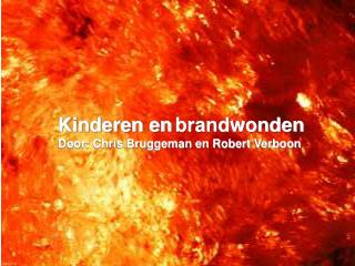 Kinderen en brandwonden Door: Chris Bruggeman en Robert Verboon