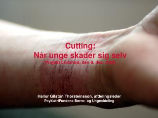 Cutting: Når unge skader sig selv Projekt Livsmod, den 9. dec. 2008