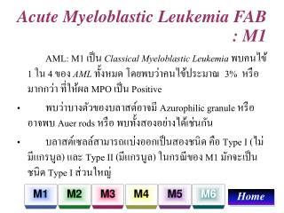 Acute Myeloblastic Leukemia FAB : M1