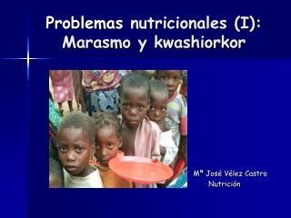 Problemas nutricionales (I): Marasmo y kwashiorkor