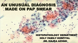 AN UNUSUAL DIAGNOSIS MADE ON PAP SMEAR