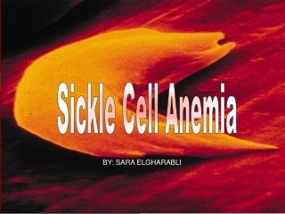 Sickle Cell Anemia