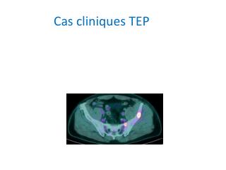 Cas cliniques TEP