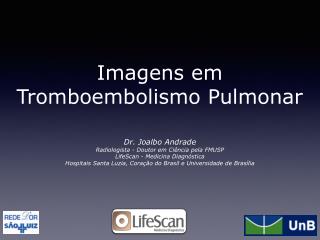 Imagens em Tromboembolismo Pulmonar