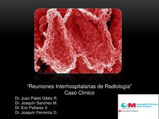 “ Reuniones Interhospitalarias de Radiología ” Caso Clínico Dr. Juan Pablo Gibbs R.