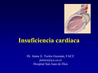 Insuficiencia cardiaca