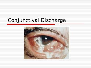 Conjunctival Discharge