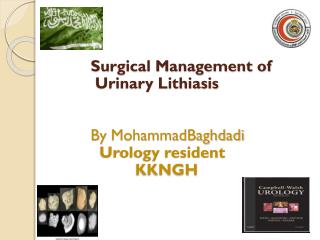 Surgical Management of Urinary Lithiasis By MohammadBaghdadi Urology resident KKNGH