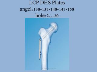LCP DHS Plates angel:130-135-140-145-150 hole:2…20