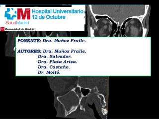 PONENTE: Dra. Muñoz Fraile. AUTORES: Dra. Muñoz Fraile. Dra. Salvador. Dra. Plata Ariza .