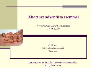 Abortusz adventista szemmel Workshop H: Család és Egészség 11.45-12,00