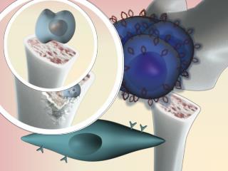 Tumor growth survival migration drug resistance Bone resorption