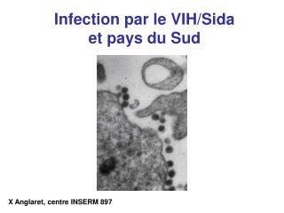 Infection par le VIH/Sida et pays du Sud