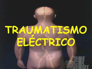 TRAUMATISMO ELÉCTRICO