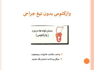 وازکتومی بدون تیغ جراحی