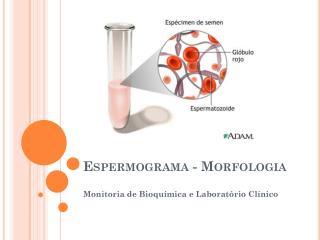 Espermograma - Morfologia