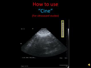 How to use “Cine” (For ultrasound studies)