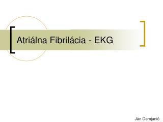 Atri álna Fibrilácia - EKG