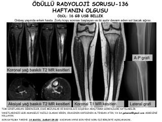 ÖDÜLLÜ RADYOLOJİ SORUSU-136 HAFTANIN OLGUSU ÖDÜL: 16 GB USB BELLEK