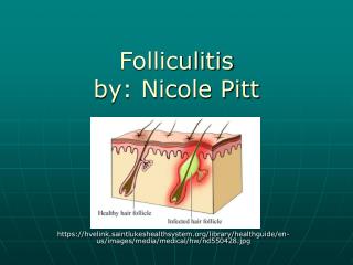 Folliculitis by: Nicole Pitt