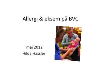 Allergi &amp; eksem på BVC