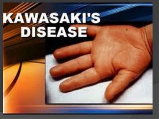 Dampak Penyakit Kawasaki Terhadap Sistem Kardiovaskular