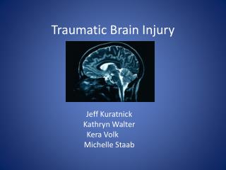 PPT - Traumatic Brain Injury PowerPoint Presentation, Free Download ...