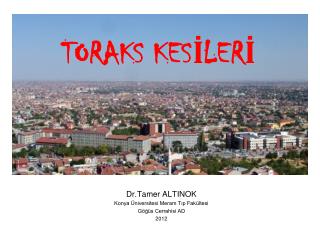 Dr.Tamer ALTINOK Konya Üniversitesi Meram Tıp Fakültesi Göğüs Cerrahisi AD 2012