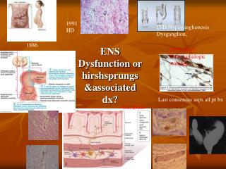 ENS Dysfunction or hirshsprungs &amp;associated dx?