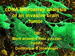 cDNA Microarray analysis of an invasive brain tumor