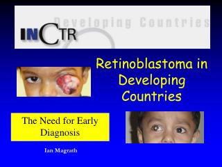Retinoblastoma in Developing Countries