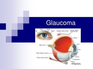 Glaucoma