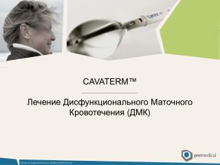 CAVATERM™ Лечение Дисфункционального Маточного Кровотечения ( ДМК )