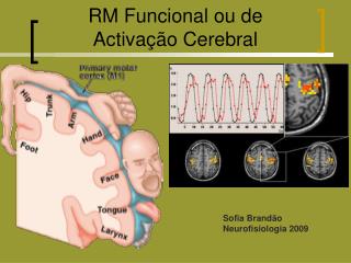 RM Funcional ou de Activação Cerebral