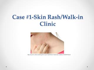 Case #1-Skin Rash/Walk-in Clinic