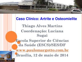 Thiago Alves Martins Coordenação: Luciana Sugai Escola Superior de Ciências da Saúde (ESCS)/SES/DF