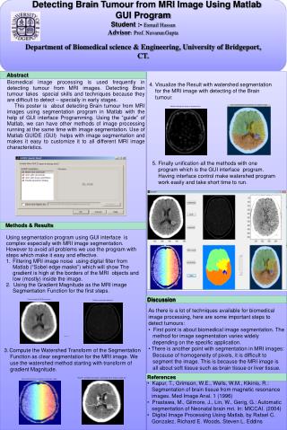 Detecting Brain Tumour from MRI Image Using Matlab GUI Program Student :- Esmail Hassan