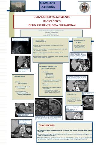 DIAGNÓSTICO Y SEGUIMIENTO RADIOLÓGICO DE UN INCIDENTALOMA SUPRARRENAL