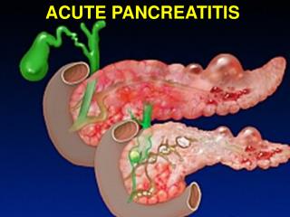 ACUTE PANCREATITIS