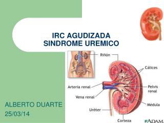 IRC AGUDIZADA SINDROME UREMICO