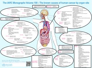 The IARC Monographs Volume 100 : The known causes of human cancer by organ site