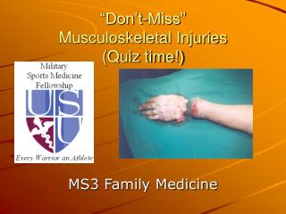 “Don’t-Miss” Musculoskeletal Injuries (Quiz time!)