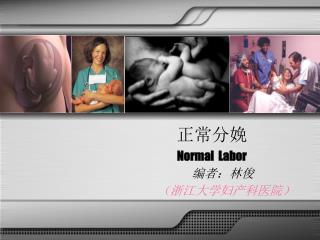 正常分娩 Normal Labor