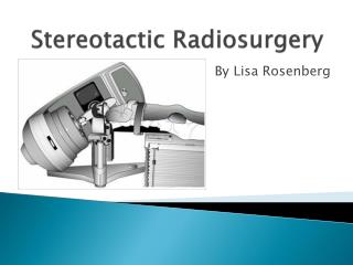 Stereotactic Radiosurgery