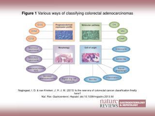 Figure 1 Various ways of classifying colorectal adenocarcinomas