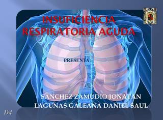 INSUFICIENCIA RESPIRATORIA AGUDA