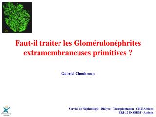 Faut-il traiter les Glomérulonéphrites extramembraneuses primitives ?