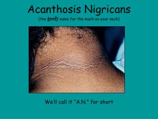 Acanthosis Nigricans (the goofy name for the mark on your neck)